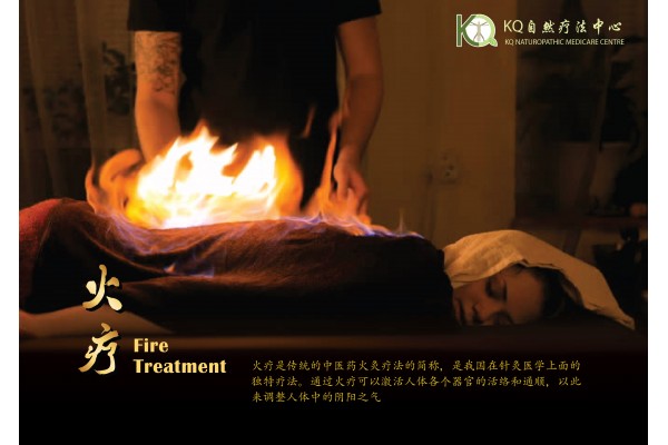 火疗 Fire Treatment (90min)